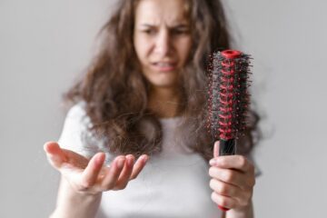 Does dandruff cause hair loss